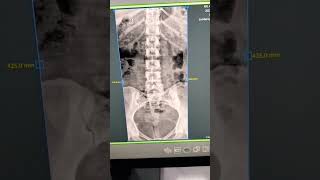 Mindray DR X-rays #DR #xrayclasses #xray#new