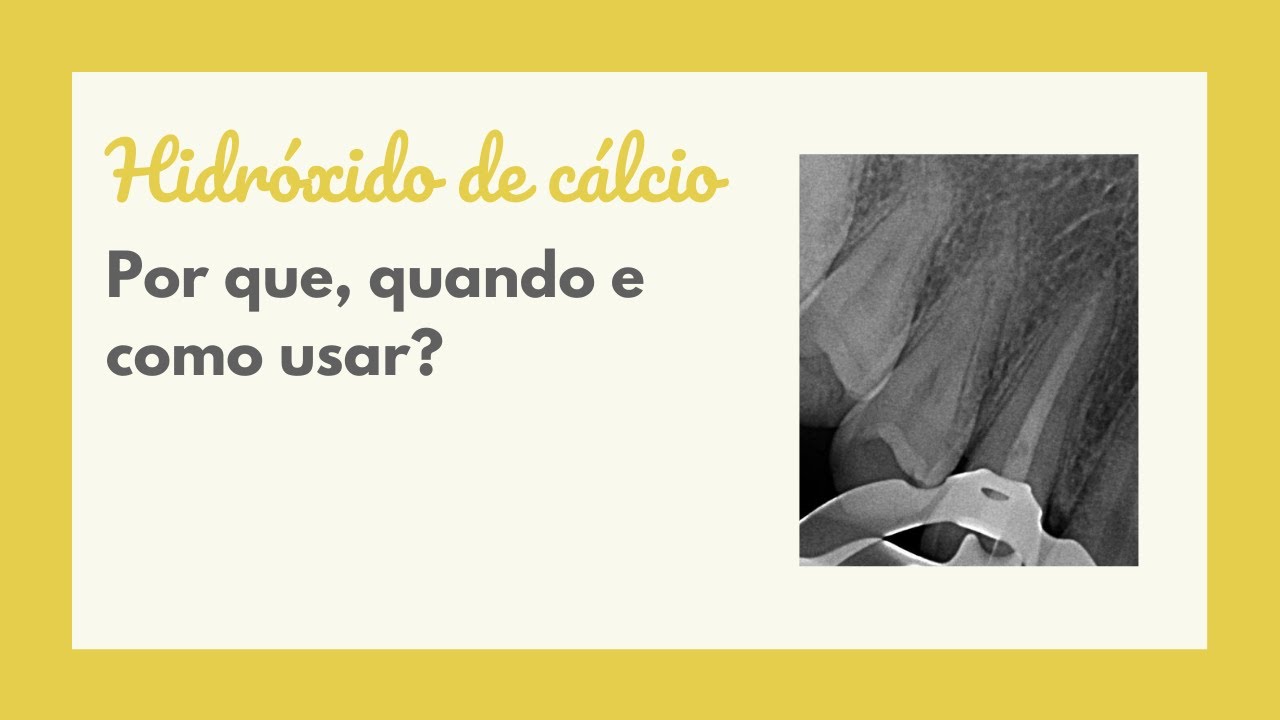Hidróxido de cálcio: Por que, quando e como usar