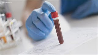 Indiana randomly selecting Hoosiers for COVID-19 testing