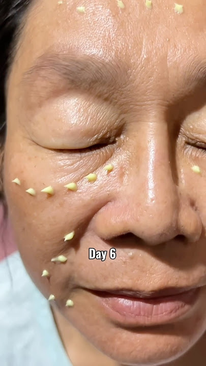 Retinal works on my mom! 😱 #skincare #retinal #seoul1988 #kbeauty #koreanskincare