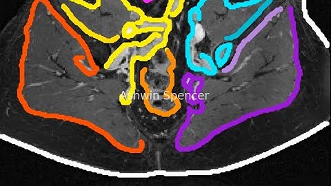 🔥 Breakthrough DBSCAN Visualization Tool for Pelvic MRI: See Clustering Like Never Before! 🔥