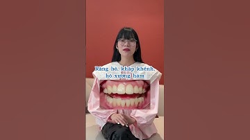 Invisalign khắc phục hô hàm, khấp khểnh sau 2 năm