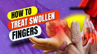 HOW TO TREAT SWOLLEN FINGERS