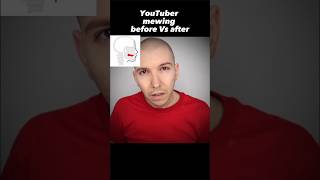 Youtuber Mewing