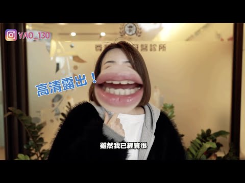 換了一張臉？！終於去做陶瓷貼片啦