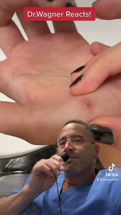 REMOVAL OF INFECTED SPLINTER😫#shorts #splinter