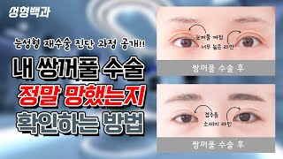눈성형(쌍꺼풀) 재수술의 정확한 진단 과정과 수술 방법