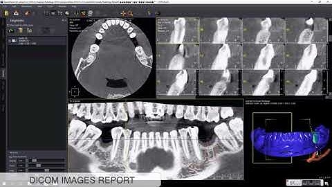 9 - DICOM Images Report