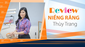 [Review niềng răng]: #116 Kết quả niềng răng của Thùy Trang