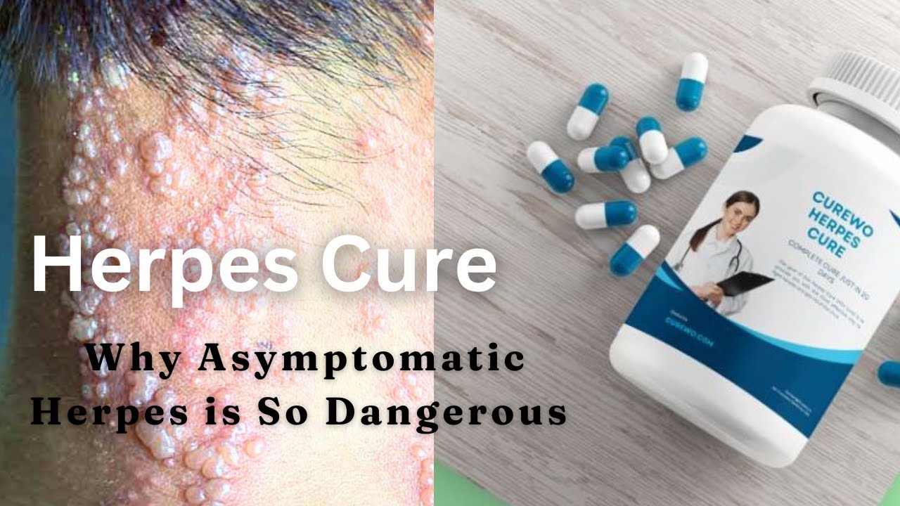 Herpes Cure 2025 & Why Asymptomatic Herpes is So Dangerous