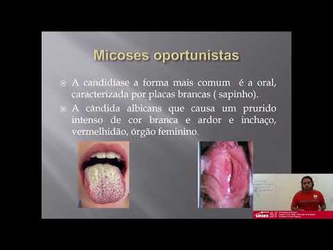 Olimpíadas de Biologia - Assunto: Reino fungi | Resolução de questões - Professor: Marcelo Augusto