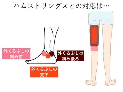 ハムストリングスが硬い意外な原因