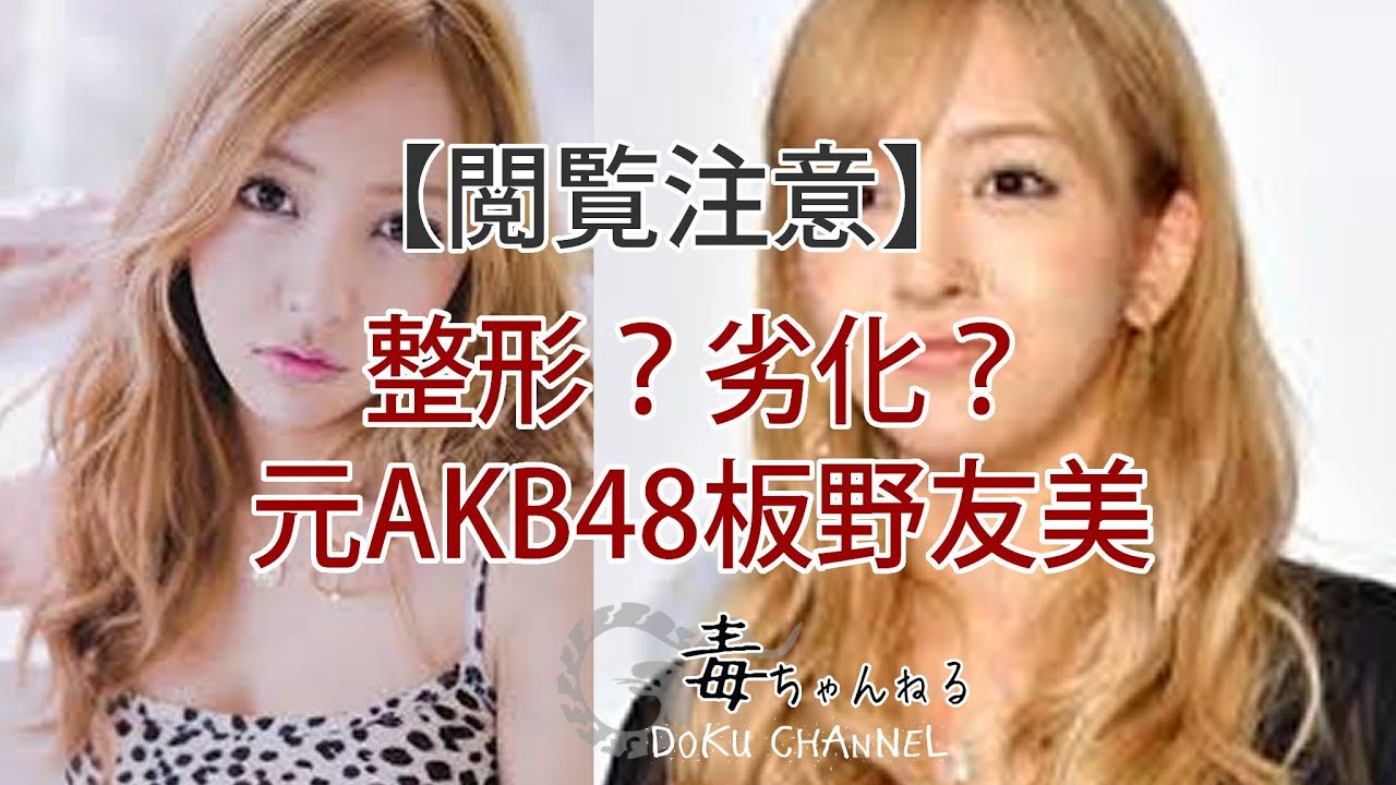板野友美 整形