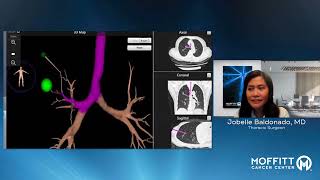An Insider's Look: Innovations in Lung Cancer Research