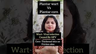 Plantar corn vs Plantar wart, #shorts, #dermatologist, #how to differentiate wart n corn on foot