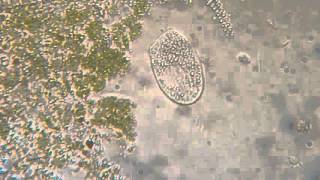 Paramecium osmosis
