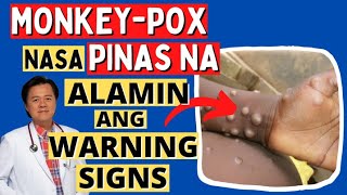 Monkey-pox Nasa Pinas Na. Alamin Warning Signs - Payo ni Doc Willie Ong #1386