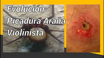 ¿Qué es la araña cobra?