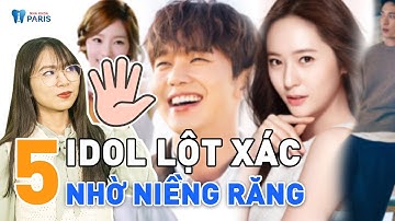 Top 5 sao Hàn lột xác thành công nhờ niềng răng