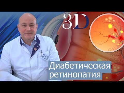 Видео: Вызывает ли оземпик диабетическую ретинопатию?