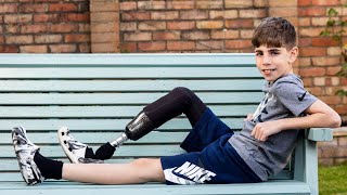 Little boy who lost his foot at 18 months now models for Primark, Amazon and Schuh | SWNS