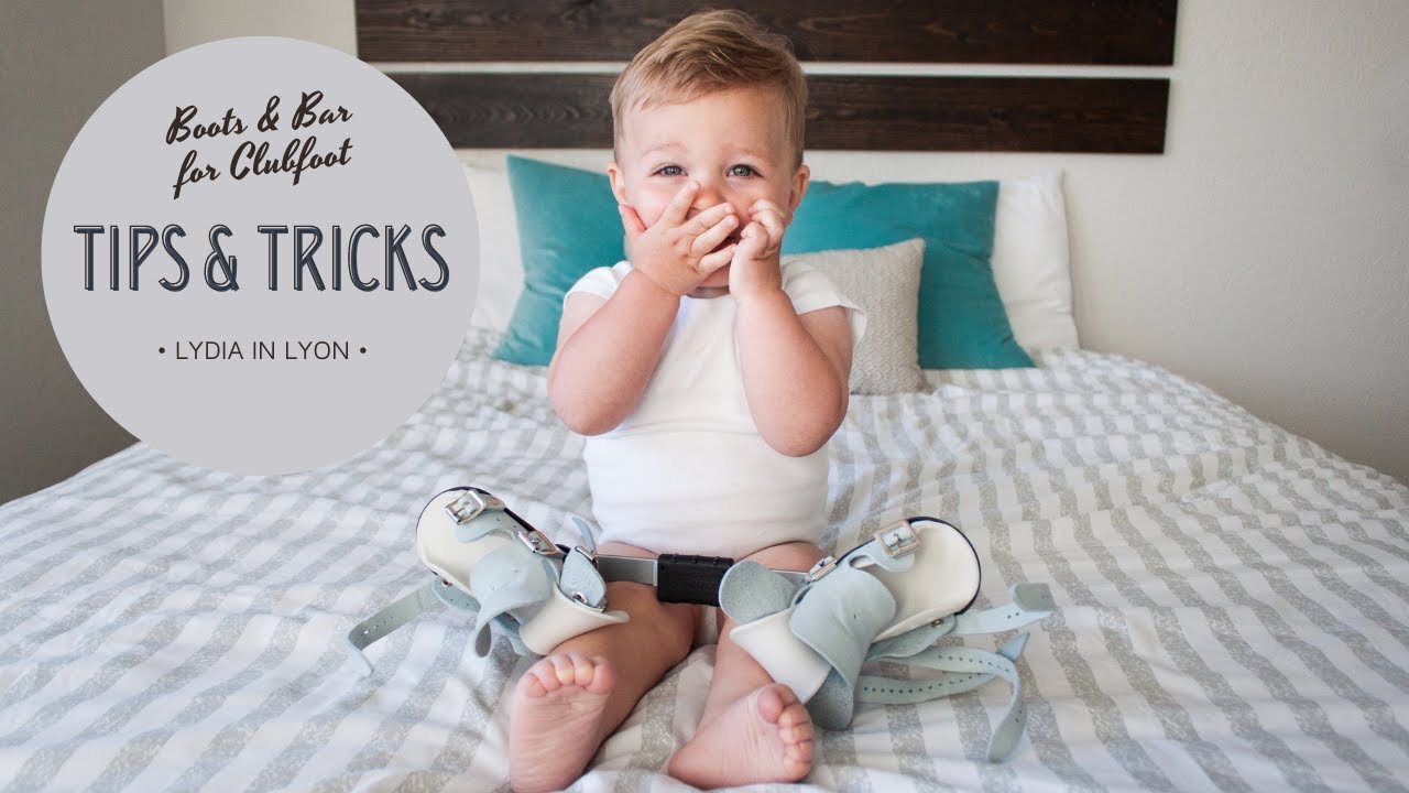 Boots and Bar (BNB) for Clubfoot: Tips & Tricks