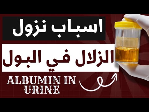 30 اسباب نزول الزلال في البول وعلاقته بأمراض الكلى   