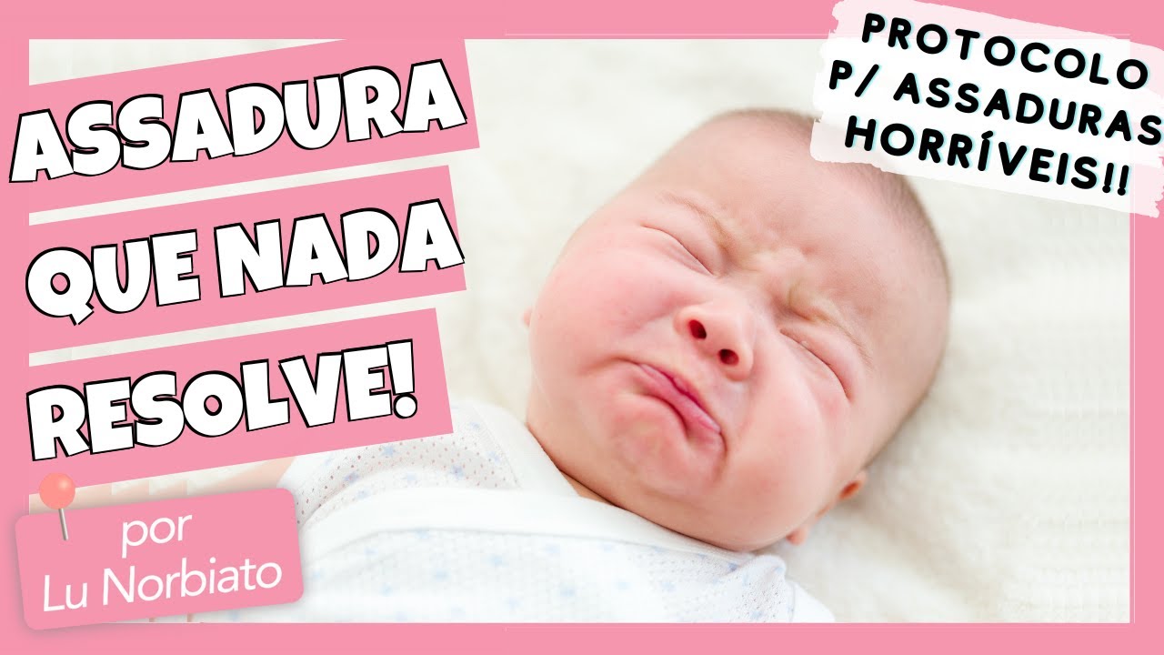 NADA RESOLVE ESSA ASSADURA! - O que fazer em casos de assaduras sérias ...