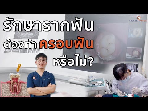 หมอโบ๊ทตอบคำถามเรื่องครอบฟัน