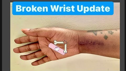 Broken Wrist/Distal Radius Fracture-2 weeks 4 days Post-OP Update-Wrist ORIF aftercare