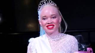 Zimbabwe’s first Miss Albino Sithembiso Mutukura