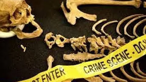 "Ive Got a Bone to Pick with You": Forensic Anthro...