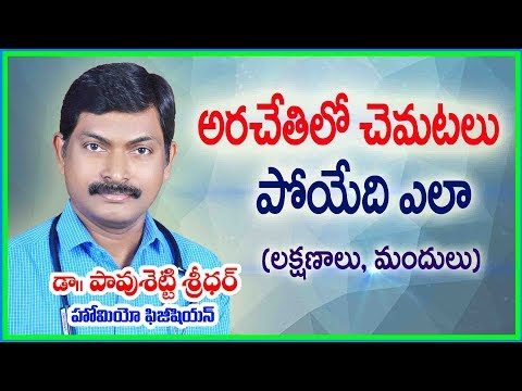 అరచేతిలో చెమటలు పోయేది ఎలా l How to Stop Sweaty Hands? | Dr. Pavushetty Sreedhar