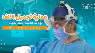 كيف يتم عملية تجميل الانف في ايران مشهد  مع طب توب اقدم شركة للسياحة الطبية في ايران ؟