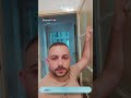العيادة رقم 1 لزراعة الشعر في أوروبا Dental Beauty Experts المركز التركي التخصصي العيادة رقم 1 لزراعة الشعر في أوروبا Dental Beauty Experts المركز التركي التخصصي