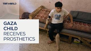 Video: 6,600 Gaza Palestinians await PROSTHETIC LIMBS (artificial leg, arm etc.) due to Israeli War, UN report | TRT World