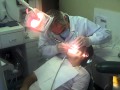 Pain Free, Needle Free bondings at The Dental Care Group