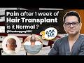 Is Pain Normal After 1 Week of Hair Transplant? Complete Guide| Ask Me ft. Dr.Jangid
