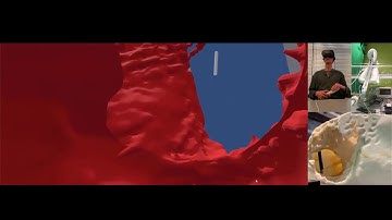 Medical Telerobotic System - Proof of concept