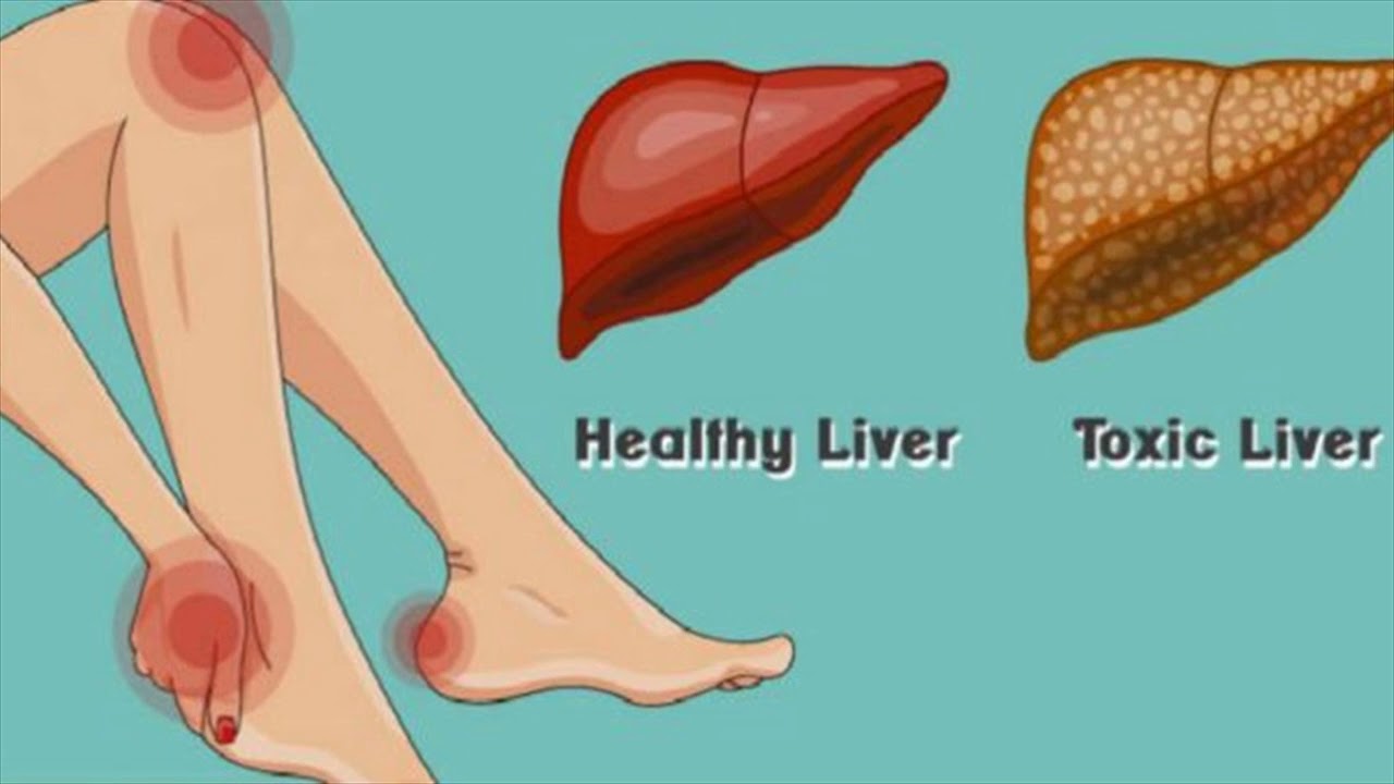 Болит печень ноги. Здоровая и нездоровая печень. Печень здоровая и больная. Ноги при болезни печени.