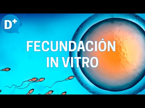 Video: ¿Por qué se utiliza la fecundación in vitro?
