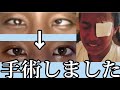 【閲覧注意⚠️】ずっとコンプレックスだった"斜視"についてお話します！👀