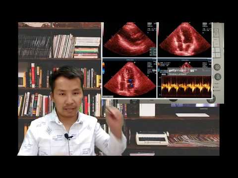 ຮຽນເຄຶ່ອງເອໂກ(echo) ຫຶຼ Ultrasound ເປັນພື້ນຖານ