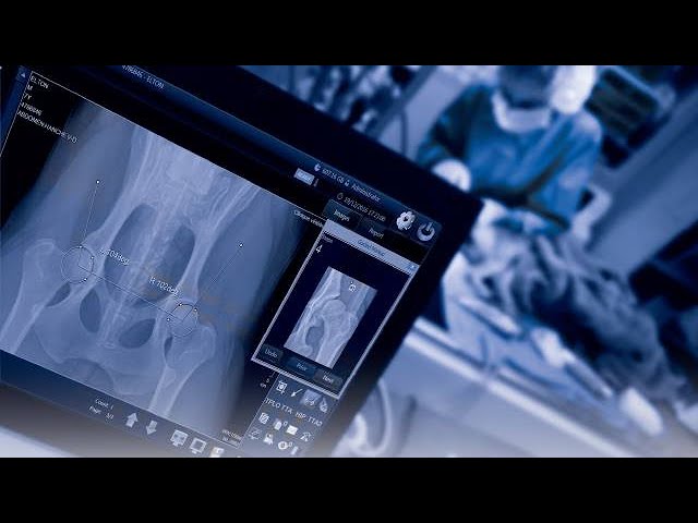 Manovet Votre Solution Mano Medical Pour La Radiologie Numerique Youtube