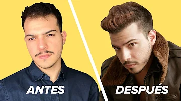 ¿Qué ocurre con el pelo viejo después de un trasplante capilar?