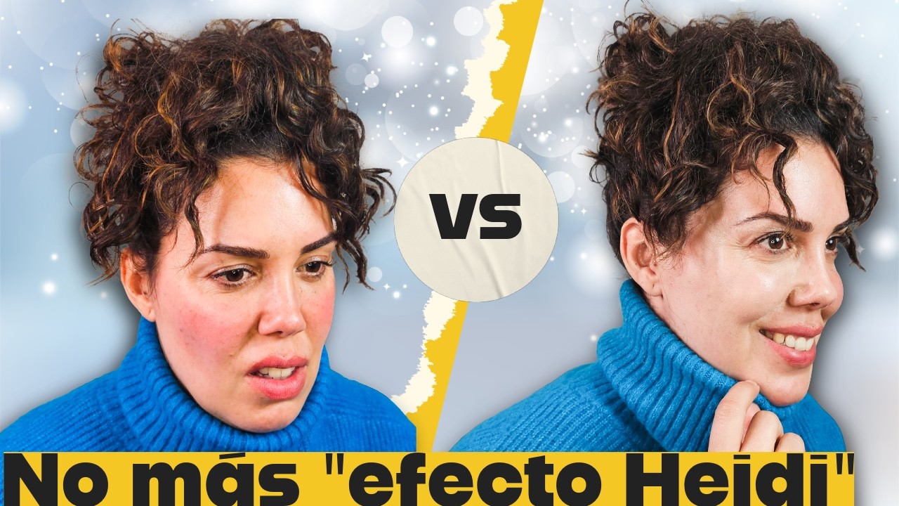 STOP ROJECES E IRRITACIÓN. CUIDA TU PIEL EN INVIERNO.