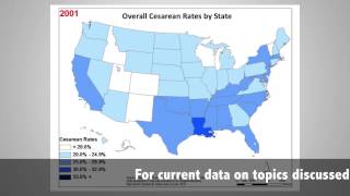 Birth by the Numbers: Myth and Reality Concerning US Cesareans