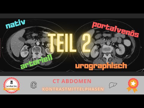 Kontrastmittelphasen in der CT - Teil 2