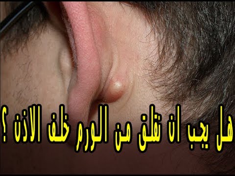 فيديو: هل تؤسس الأذن الأذن بيضًا في الأذن؟