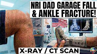 NRI Dad's Medical Emergency in USA🇺🇸 Garage Fall Ankle Fractured &amp; Clinic Visits #kannada #vlog